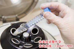 呵护精子，男人要做好这几件事